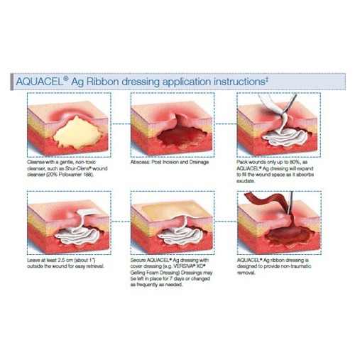 AQUACEL AG YARA ÖRTÜSÜ 15X15 CM 403710 HYDROFİBER