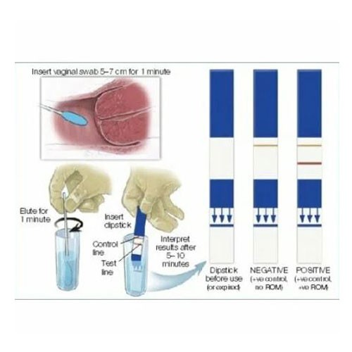 Тест На Подтекание Околоплодных Вод Купить Amnisure